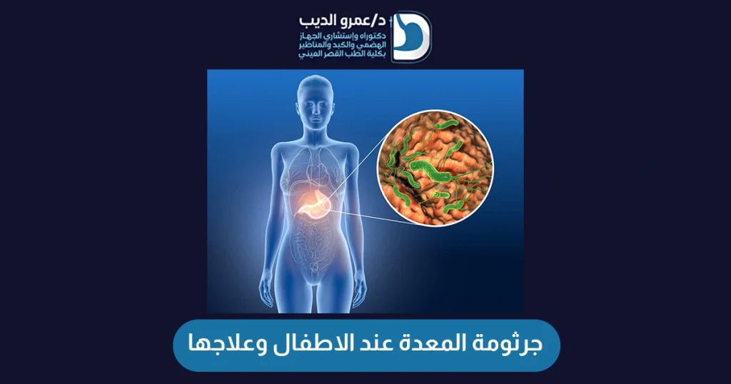 جرثومة المعدة عند الاطفال وعلاجها