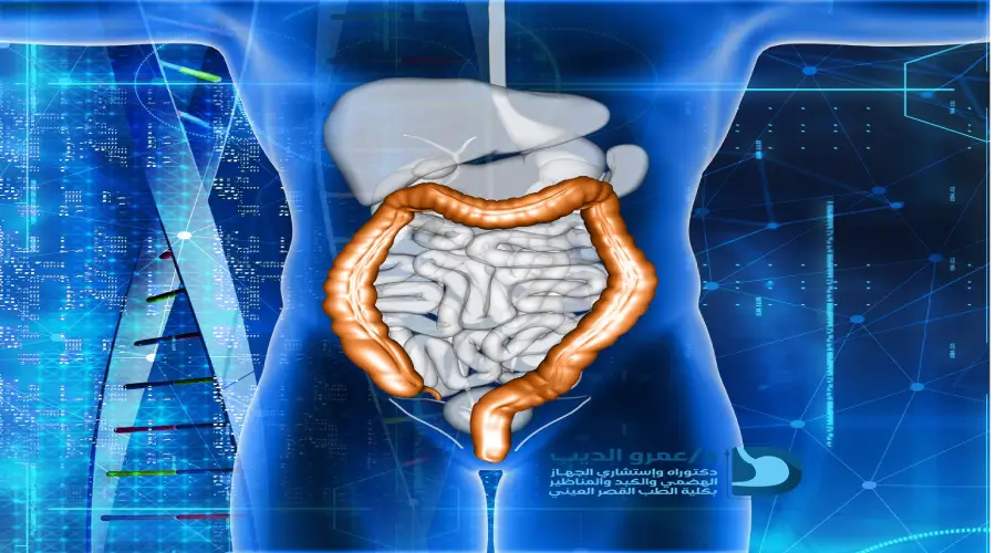 عمليات منظار القولون