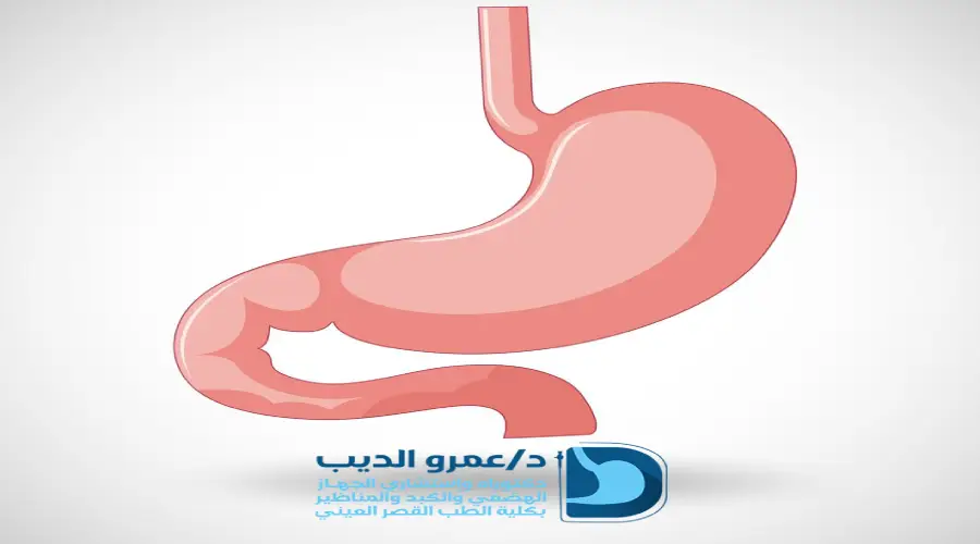 اعراض ارتجاع المريء الصامت