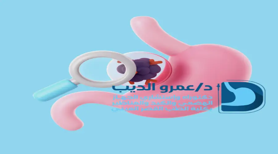 استئصال-القولون-بالمنظار