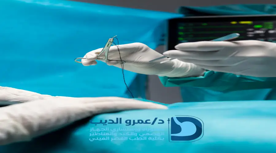 عملية تكميم المعدة بالمنظار في مصر