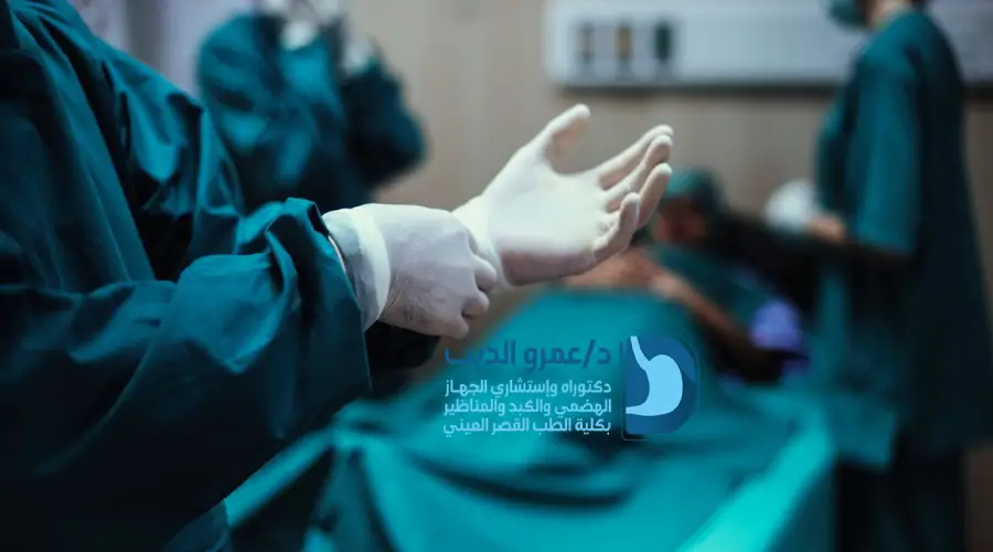 عملية تكميم المعدة بالمنظار في مصر