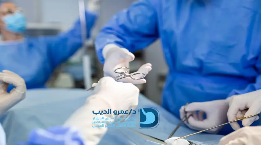 عملية تكميم المعدة بالمنظار في مصر