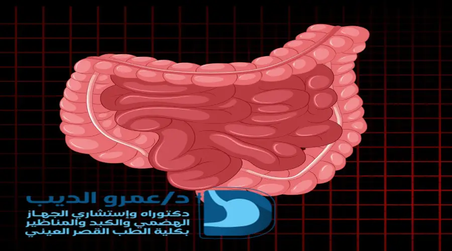 منظار القولون