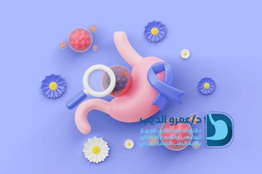 منظار-المعدة