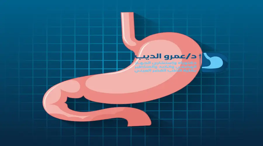 منظار-المعدة