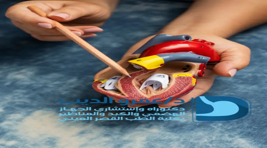 منظار-المعدة